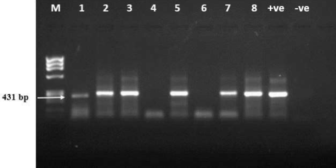 analyzes of PCR products in Ethidium bromide stained agarose gel to perform amplification of 431 bp of aer gene amplicons in A. hydrophila. Lane M: DNA marker,