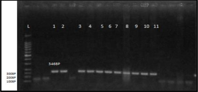 the amplification of  stx2gene of E.coli isolates were fractionated on 1.6% agaroses gel electrophoresis stained with ethidium Bromide. L: 100bp ladder marker. Lanes 1-11 be similar to 346bp PCR products