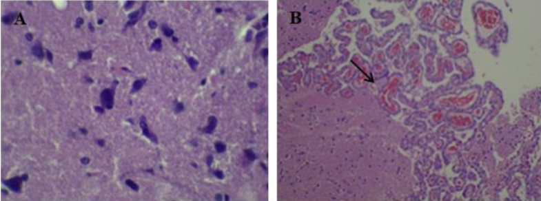 Histopathological sections of brain tissues in male rats from control group G1(A) and treated group with BTEX mixtures 600 mg/kg/B.W. for 12 weeks G2 (B). (A): brain tissue shows normal structure of neuron cells. (B): congestion of the meninges with mild focal inflammation. H & E (A x40, B x40)