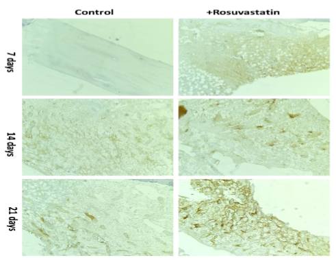 Rosuvastatin-induced bone osteogenesis marker CD34