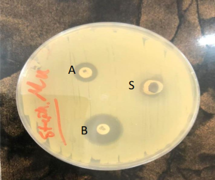 Antimicrobial activity of two concentration of  chitosan against S.aureus. A=0.5%chitosan , B =1% chitosan, S=normal saline