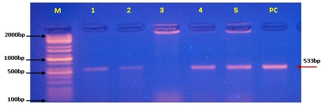 Agarose-gel electrophoresis (2%) in targeting the mecA gene